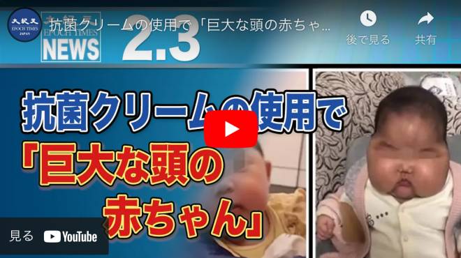 抗菌クリームの使用で「巨大な頭の赤ちゃん」