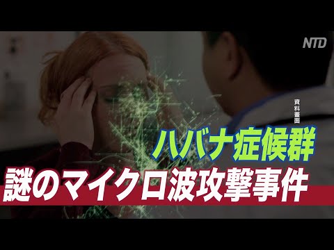 「ハバナ症候群」引き起こすマイクロ波攻撃事件 米政府が調査