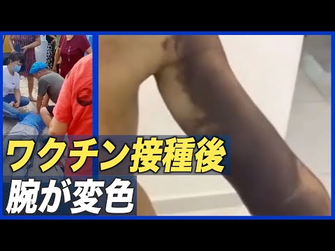 中国製ワクチンへの広がる不信 特典で接種後押し