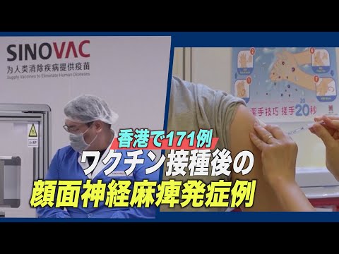 ワクチン接種後の顔面神経麻痺発症例 香港で合計171例