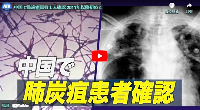 中国で肺炭疽患者１人確認 2011年以降初めて【動画】