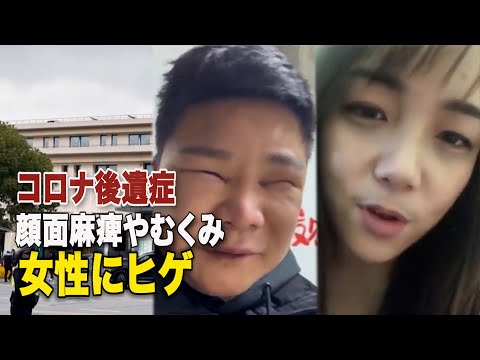 中国のコロナ後遺症 顔面麻痺やむくみ 女性にヒゲ