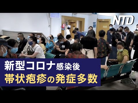 【ダイジェスト版】 習近平氏、常識破りの席次でブリンケン氏と会談/新型コロナ感染後、帯状疱疹の発症率が高い など