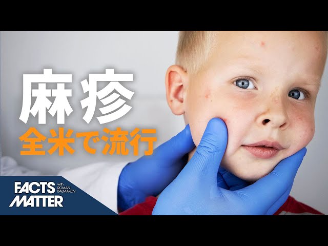 全米で麻疹が流行、CDCはわずか2週間で患者数が100％急増と報告 | Facts Matter | TEASER