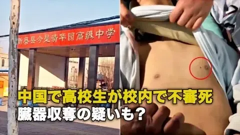 中国で高校生が校内で不審死 臓器収奪の疑いも？
